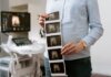 Медсёстры отделения фетальной диагностики спасают жизни до рождения