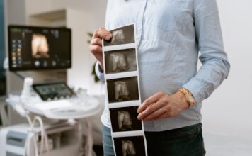 Медсёстры отделения фетальной диагностики спасают жизни до рождения