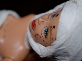 Conceptual image of a mannequin depicting plastic surgery with marker lines.