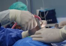 14-летняя Клоэ стала первой пациенткой в Манитобе, перенёсшей операцию sEEG на мозге Close-up of surgeons operating in a hospital theater setting with precision.